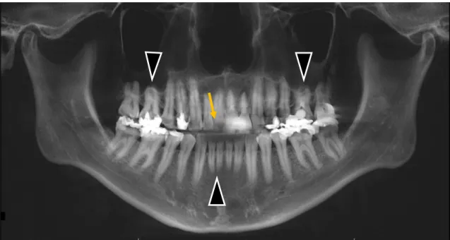 Figure 2 ： 30 歳代男性の CBCT 再構成パノラミック画像