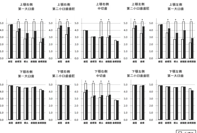 Figure 4 ：混合歯列におけるパノラマ写真と CBCT 再構成パノラミック画像の比較 