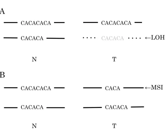 Figure  1.  Schematic  diagram  of  LOH  (A)  and  MSI  (B).  N,  non-tumor;  T,  tumor; LOH, loss of heterozygosity; MSI, microsatellite instability
