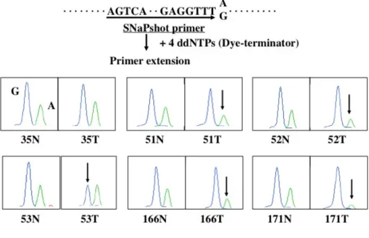 Figure  3.  Analysis  of  LOH  of  the  VHL  gene.  We  performed  quantitative  primer  extension  analysis  using  dye  terminators  at  the  A-to-G  SNP  at  position  c.1008  in  the  VHL  gene