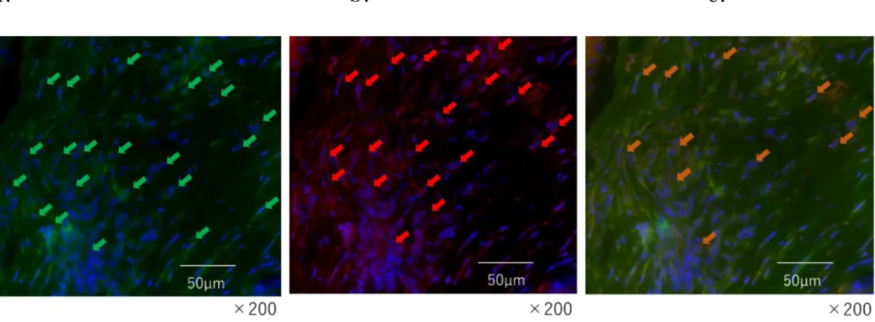 図 7 ． CXCR3 、 CD4 の 免 疫 組 織 化 学 染 色 の 検 討