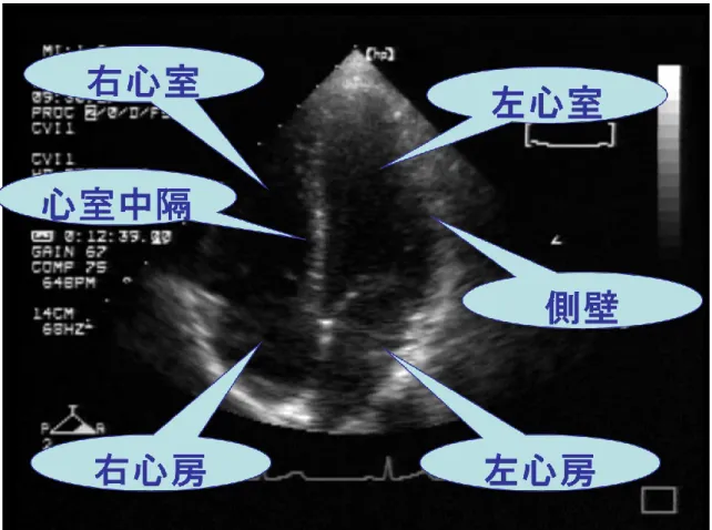 図  ５  心尖部四腔断面 