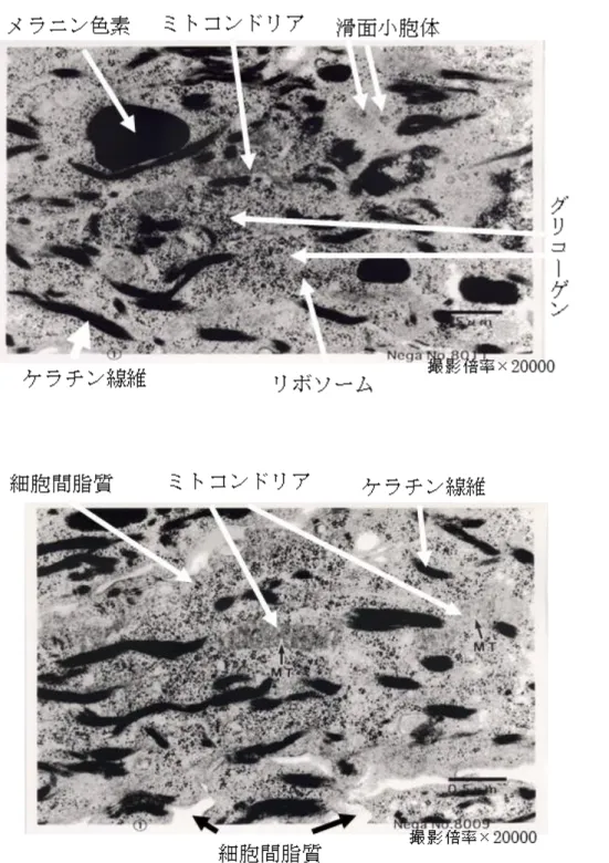 Figure 3-1.  毛乳頭領域の TEM 写真