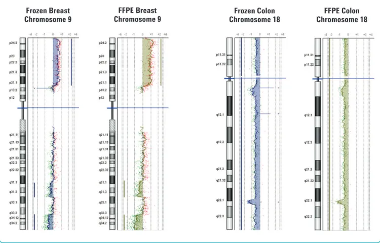 Figure 4. Chromosomal aberration analysis comparing fresh and frozen FFPE samples from the same tumor