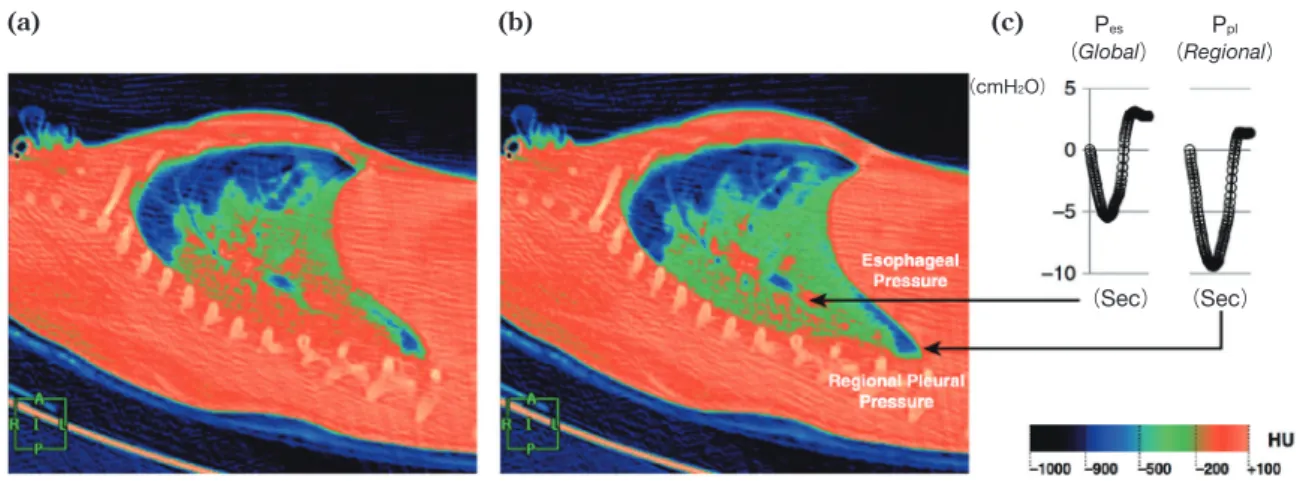 Fig. 2	 Spontaneous	effort	and	distribution	of	regional	ventilation	and	pleural	pressure