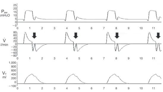 Fig. 5	 Premature	cycling