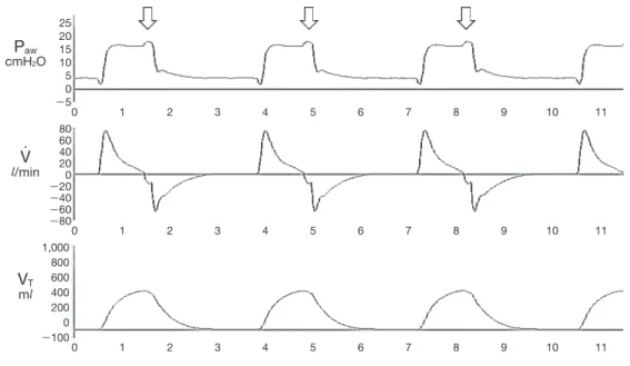 Fig. 6	 Delayed	cycling