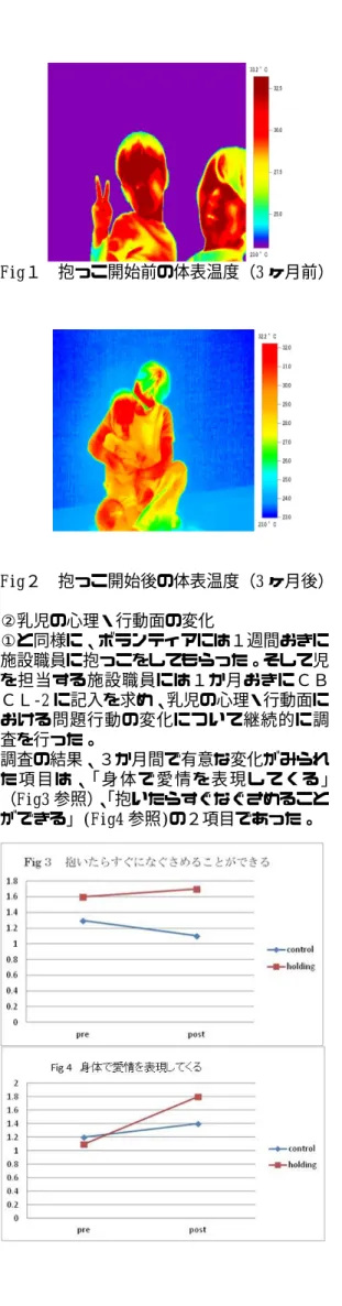 Fig１  抱っこ開始前の体表温度（3 ヶ月前）  Fig２  抱っこ開始後の体表温度（3 ヶ月後）  ②乳児の心理・行動面の変化  ①と同様に、ボランティアには１週間おきに 施設職員に抱っこをしてもらった。そして児 を担当する施設職員には１か月おきにＣＢ ＣＬ-2 に記入を求め、乳児の心理・行動面に おける問題行動の変化について継続的に調 査を行った。  調査の結果、３か月間で有意な変化がみられ た 項 目 は、「 身 体 で 愛情 を 表 現 して く る 」 （Fig3 参照） 、 「抱いたらすぐなぐ