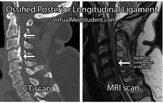 Figure 3.2 CT vs MRI scans 