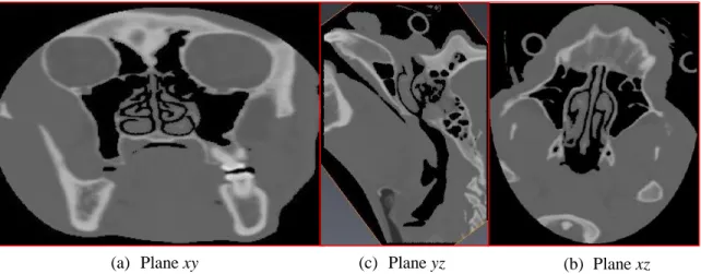 Figure 3.4 Slice samples of CT scans of the chimpanzee head: (a) Plane xy, (b) Plane yz, (c) Plane xz