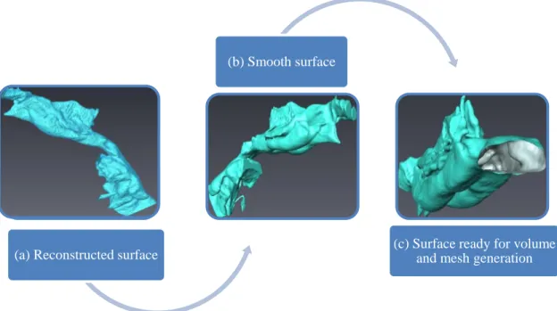 Figure 3.8 Surface ready for volume mesh generation. 