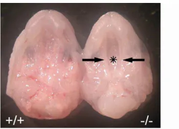 Figure 7. Cleft palate in VGAT   mice   