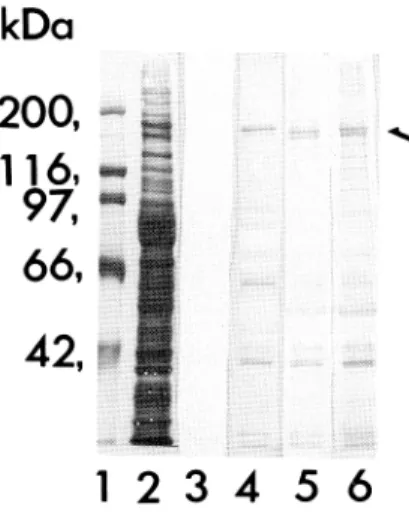 Fig.  1  Anti-Mycoplamsa  pneumoniae  antibodies found  in  human-normal  immunoglobulin  product by  Western  blotting