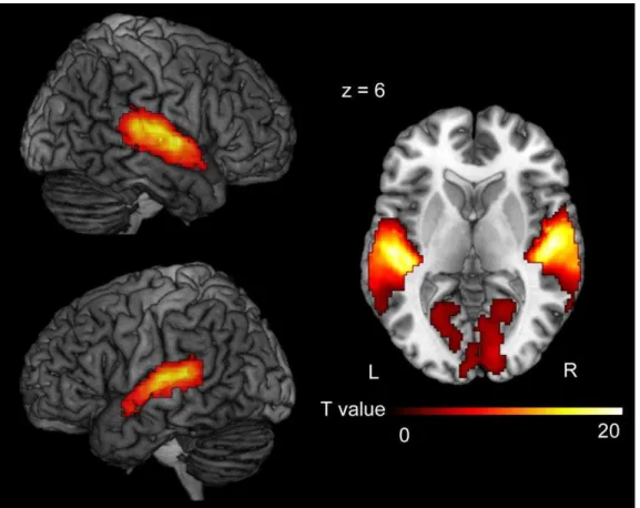 Figure 5 . The effect of listener’s response (Group minus No Laughter) 