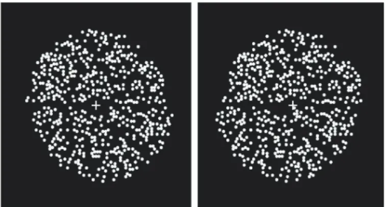 図 1.2  下部の半円にパナムの融像限界を上回る視差を割 り当てられたランダムドットステレオグラム  ある点を固視したとき，両眼の網膜対応点に結像する外界の点の軌跡(ホロプタ)の前後に形成される融像可能な領域をパナ ム の 融 像 圏 ( 融 像 限 界 ) と い う ( 丸 尾ら,2009)。パナムの融像圏と網膜対応点の関係を図1.1 に示した。図 1.1 に示すように，ホロプタ上の点Fを固視点とするとき，点A は，左眼では A１上に像を結び，右眼ではその対応点A2上で像を結ぶが，A2から一定範囲内の