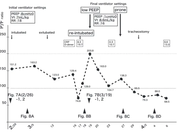 Fig. 6 Case 2 terminal progress chart 50100150200250P/F ratio