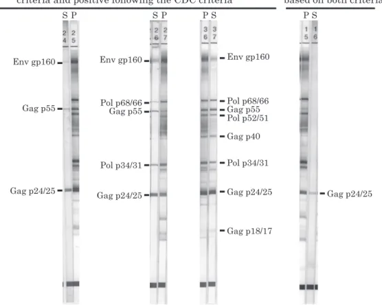 Table 3 Detection  frequency  of  three  Env  and  Gag  p24  bands  when  HIV-1  positive  specimens  in  Japan  were  tested  with  NEW LAV BLOT I Env  gp160 Env gp120 Env gp41 Gag p24 ＋ 88 85 81 89 −   1   4   8   0 Frequency (%) 98.9 95.5 91.0 100 Fig. 