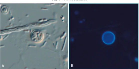 Fig. 2 Stool Specimens