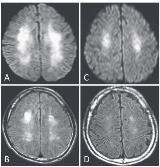 Fig. 2 MRI imaging on day 1 and day 13