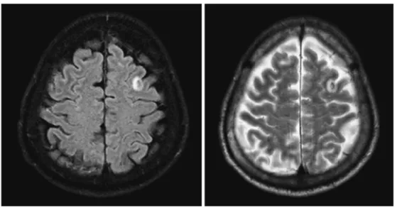 Fig. 1 Head MRI on hospital day 2 (Case1)