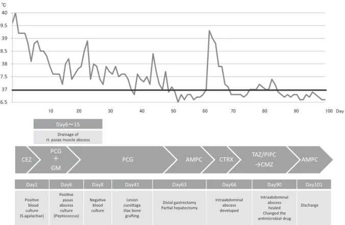 Fig. 7 Clinical course (Case2)  CEZ: Cefazolin, PCG: Benzylpenicillin, GM: Gentamicin, AMPC: Amoxicillin, CTRX: ceftriaxone, TAZ/PIPC: Tazo-bactam＋Piperacillin, CMZ: Cefmetazole 36.53737.53838.53939.540Υ CTRX䠇PCG㻝㻜㻞㻜㻟㻜 㻠㻜 㻡㻜 㻢㻜 㻣㻜 㻤㻜 㻥㻜 㻝㻜㻜 㻰㼍㼥CEZPCG䠇GMPCG