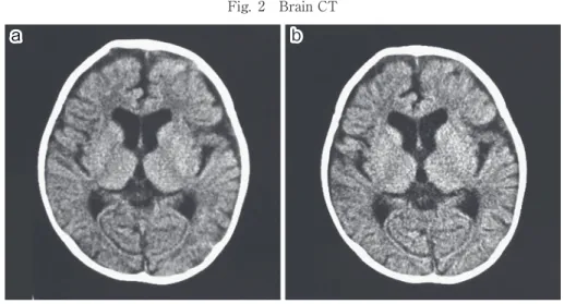 Fig. 2 Brain CT