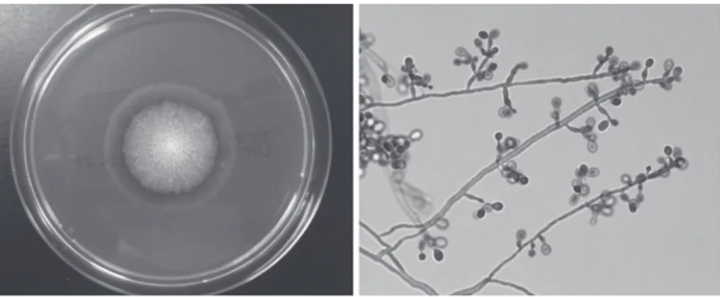 Fig. 3 Colony  on  Sabouraud  dextrose  agar  and  hyphae  with  typical  conidia  and  conidiogenous cells growing in slide culturepg!mL と著増し，カンジダ抗原は陽性（力価 4 倍），アスペルギルス抗原は陰性であった．真菌学的所見（Fig