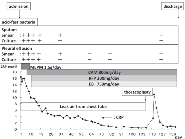 Fig. 2 The  process  changing  from  positive  (＋)  to  negative  (−)  findings  of  acid-fast  bacteria  in  the sputum, the pleural effusion and clinical course