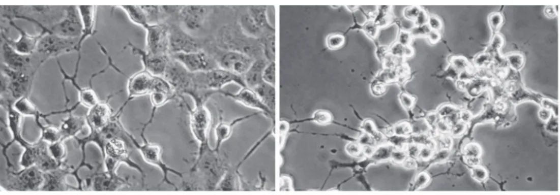 Fig. 1 Isolation of parechovirus using Vero cells Fig. 2 Electronography of parechovirus され，それらのウイルスは HPeV であった． ま た 培 養 上 清 3mL か ら 小 型 超 遠 心 機 を 用 い て HPeV を濃縮精製し，電子顕微鏡にてウイルスを観察 した（Fig