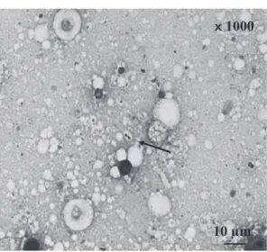 Fig. 5 PCR  detection  of  pneu- pneu-mococcal  specific  gene,  lytA. 