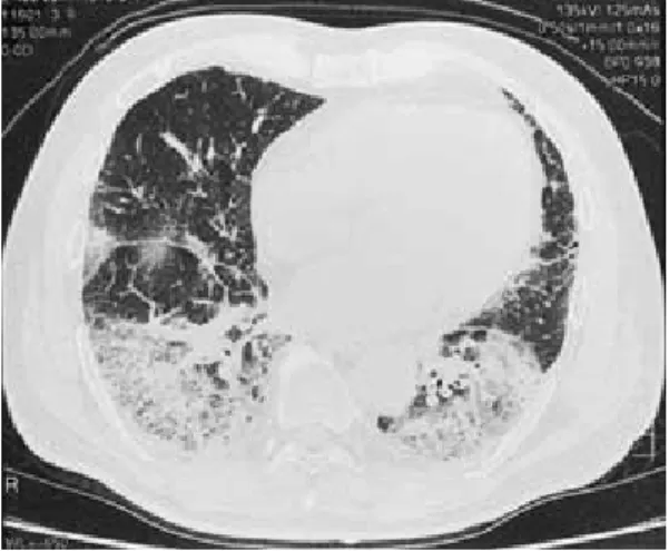 Fig. 4 Clinical course