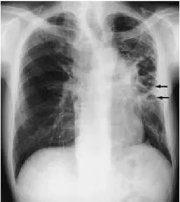 Fig. 3 The clinical course shows initial improvement during hospitalization, followed by abrupt deterioration.