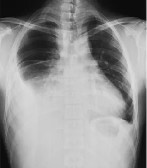 Fig. 2 A chest CT obtained on admission.