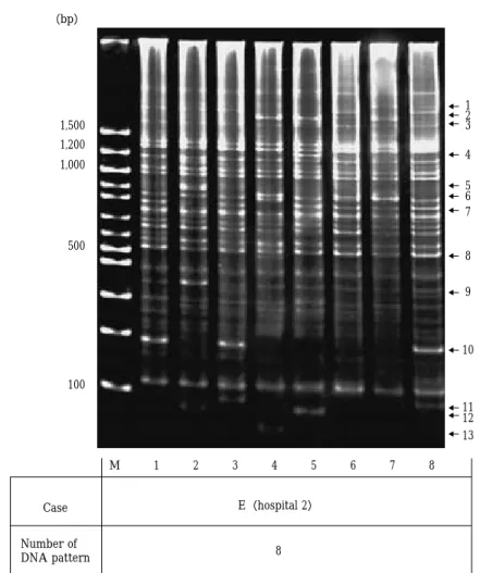 Fig. 6 DNA finger printing of Mycobacterium tuberculosis by AP-PCR method-2（3.5％