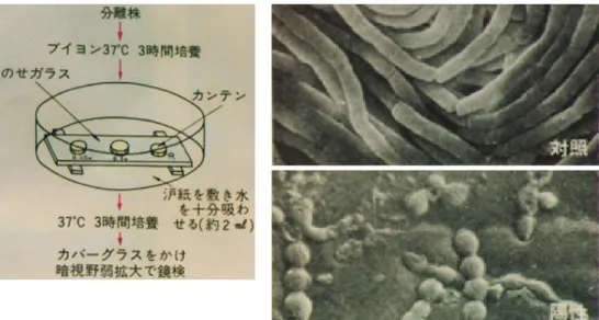 図 18 炭疽菌の走査電顕所見．集落周辺のメズーサ ヘッド（ブロンドのカールした髪と私は表現）