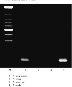 Fig. 2 Detection of plasmodium DNA by PCR in case 2. The DNAs were amplified by specific primers for P