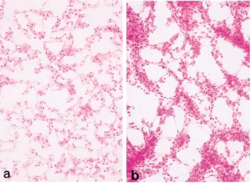 Fig. 1 Microscopic findings of the mice lung tissue on the day 2nd.