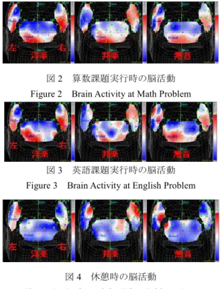 Figure 2  Brain Activity at Math Problem 