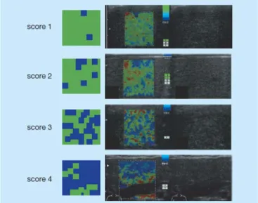 図 7  Liver Elasticity Score（文献 4 より引用） 