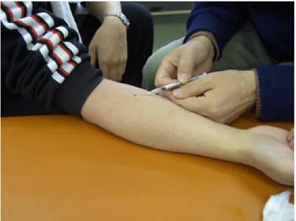 Fig.  1   Intracutaneous injection for the induction of pruritus