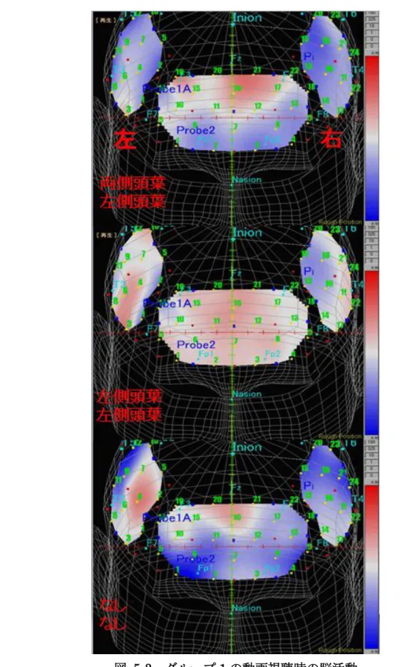 図  5-3  グループ 1 の動画視聴時の脳活動 