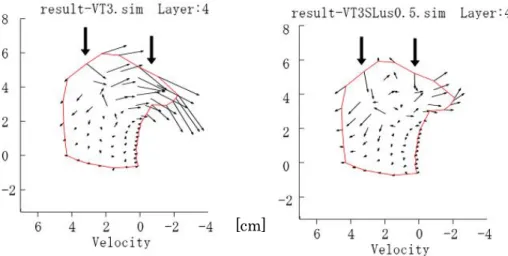図 5.2.2  図 5.2.1 における舌尖の軌跡：赤線△印は VT3N，緑線※印は VT3N と SL0.5N の負荷である．計算時間は 0.2sec で 20 ステップ分を表示，左上が舌尖の初 期位置      図 5.2.1 の左を見ると，2 箇所で負荷がかかっている場合，3.1 章で考察された V と T のみでのシミュレーションでは図 3.1 で見られた風船効果のような明瞭な速度パターンが 観察できなかった．負荷をかけた太い矢印の間の速度場がすべて突出しの方向へ向かって いるのがわかる．この問題