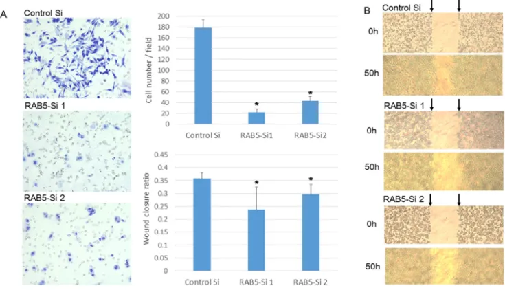 Figure 3: Functional analysis of RAB5 by small-interfering RNA (siRNA).  A. RAB5 protein levels were measured by western  blotting for pancreatic cancer cell lines