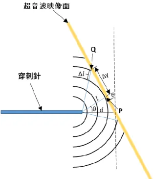 Fig. 4-3-2  穿刺針と超音波映像面 