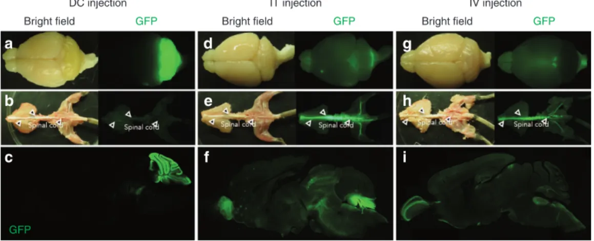 Figure 2  GFP expression profiles in the CNS resulting from the three different routes of administration of the ssAAV9 vector