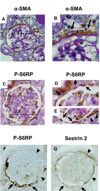 Figure 4 Sestrin 2P-S6RPFGP-S6RPP-S6RP䠆䠆CDE