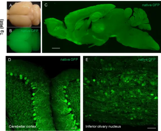 Fig. 5. Native GFP in the brain of a transgenic mouse (no. 68, P185) expressing GFP and ATXN1[Q98]