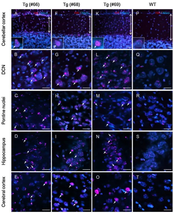 Fig. 6. ATXN1[Q98] aggregates in neurons of various regions primarily affected by SCA1