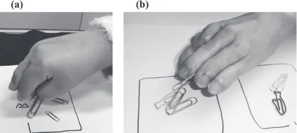 Fig. 5.　Patient 4 peeled off a sticker using all digits of a hand.