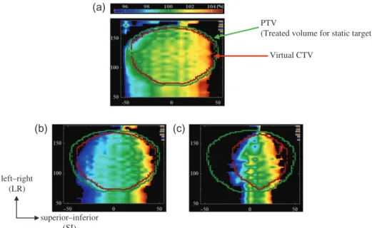 Figure 11 shows the range variation in the virtual CTV, where the abscissa indicates the lateral positions